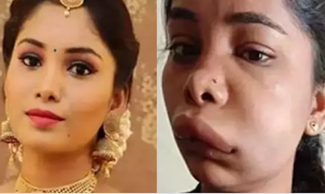 Swathi Sathish ends up with a swollen face after tooth surgery goes wrong