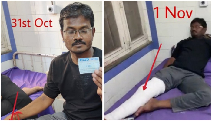 Truth about Morbi tragedy survivor's 'changing plaster' fake news