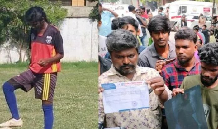 Chennai: Teenage footballer dies after losing leg in botched surgery