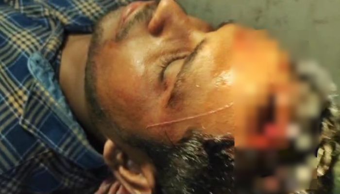 West Bengal: ANI stringer suffers severe head injury in poll violence in Canning