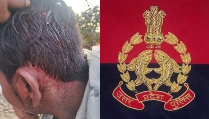 UP: Fast food vendor brutally attacked, assaulted by Abdul, Pappu and 2 others in Bareilly